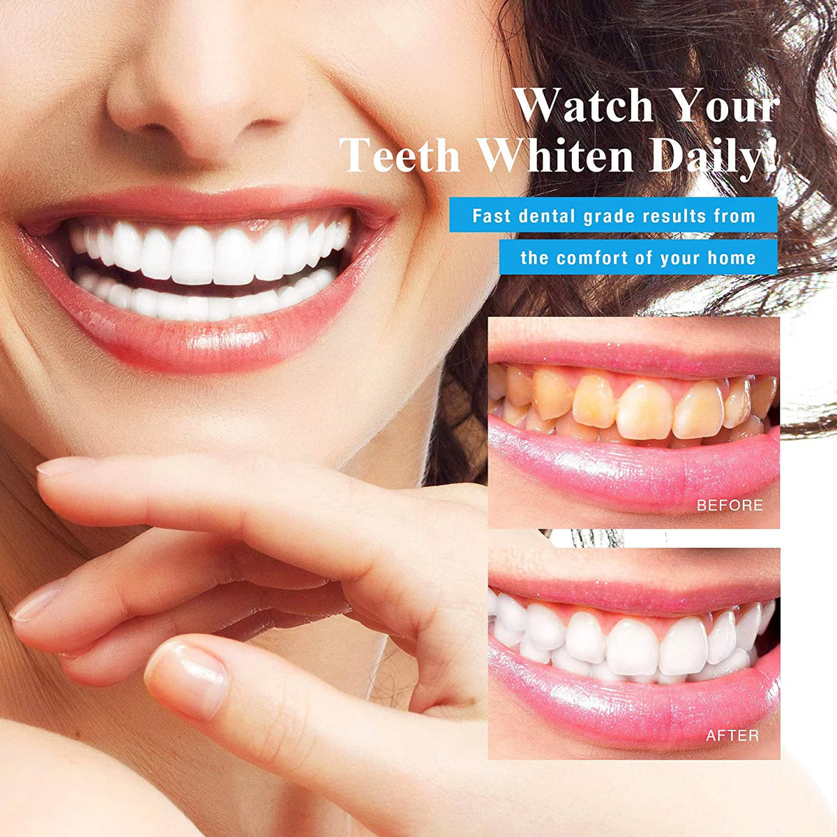Teeth Whitening Kit with LED Light and Mouth Trays Q262