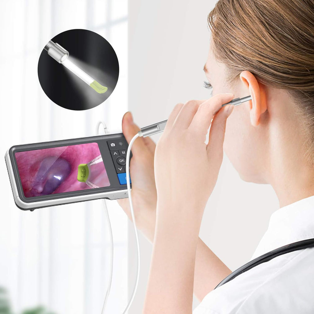 Digital Otoscope with 4.5 Inches Screen, 3.9mm Ear Camera, 6 LED Lights, 32GB Card, Ear Wax Removal Tool, 2500 mAh Rechargeable Battery, Pack of 2 F71163